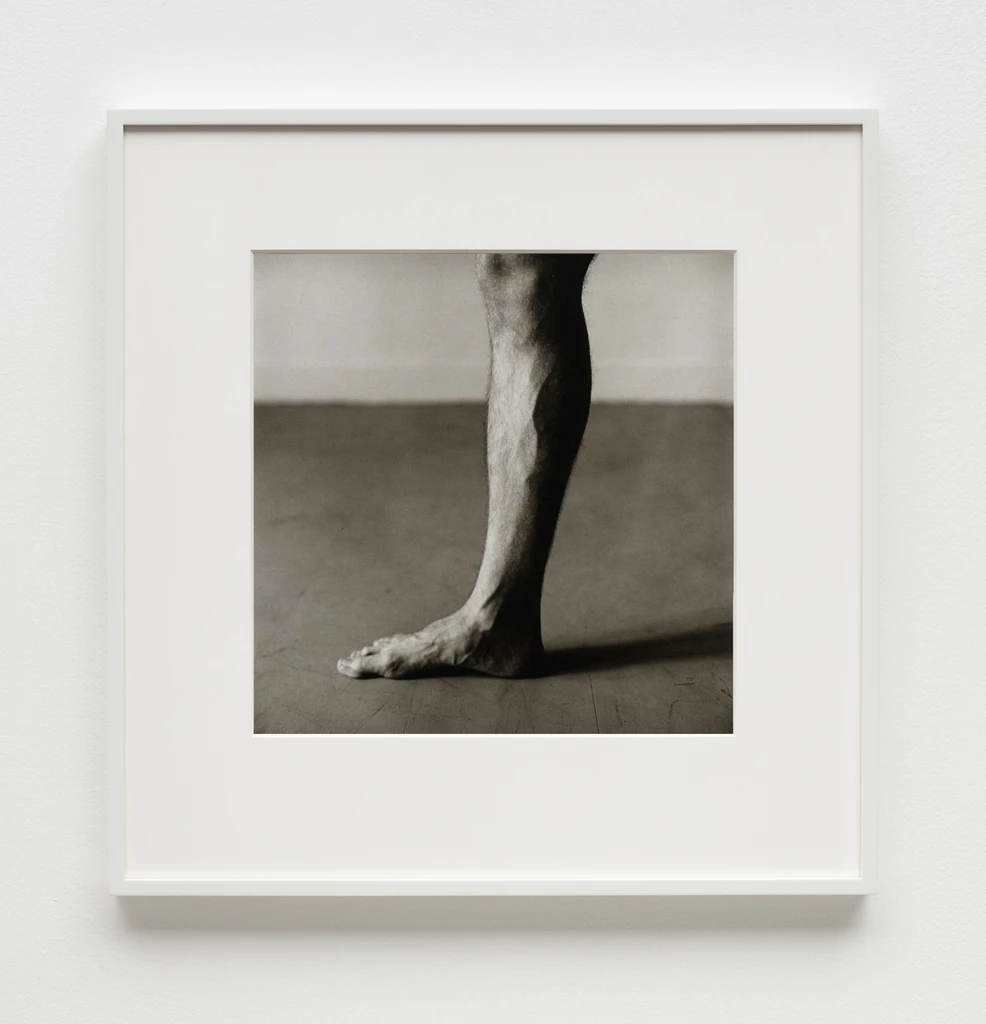 Paul Hudson's Leg